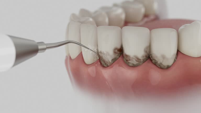 Reliable Dental Implants contractor in Acushnet Center, MA by Smile Center Dentistry